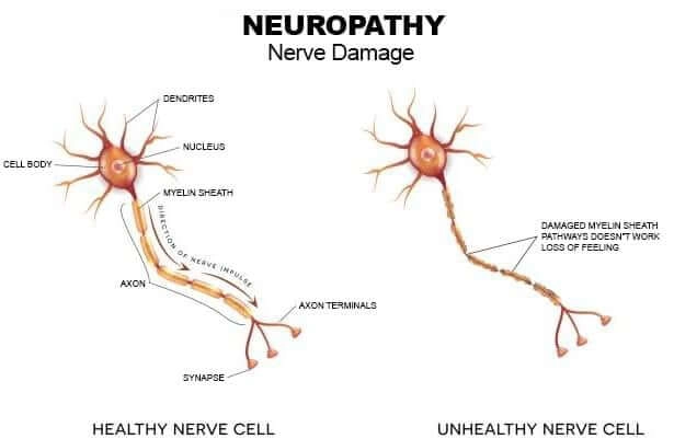 Nerve Alive result no.1